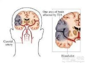 小脑洞大爆发游戏攻略