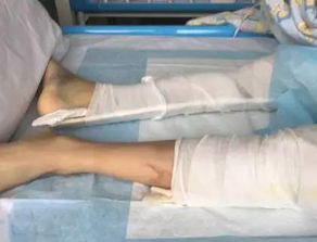 孕妇羊水破裂13岁男孩成功助产