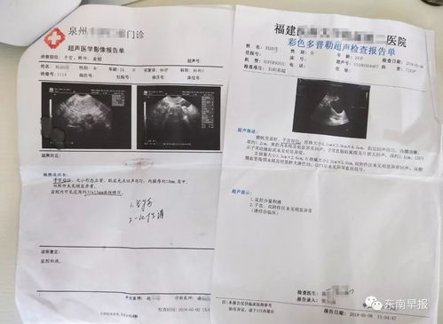 未生育女子术中被要红包 子宫被全切 未生育女子术中被要红包 子宫被全切