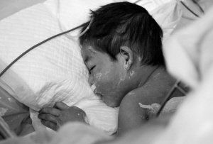 2岁娃烧伤 婆婆给儿媳下跪自责痛哭