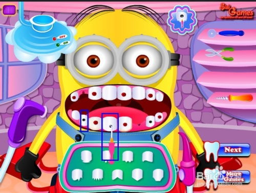 游戏我是牙医攻略