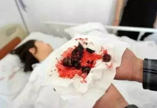 巴西女子砍下丈夫生殖器煮汤