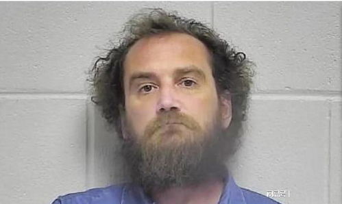 哈佛医学院涉及盗卖人体遗骸