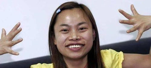 牙烂了人胖了 初代网红凤姐近况曝光