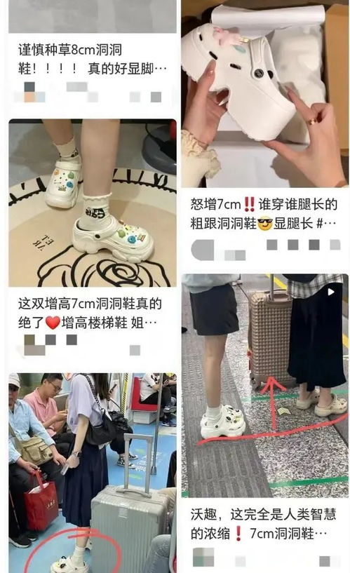 女子常穿洞洞鞋致足底钙化行走困难