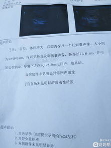 百事公司回应确诊病例事件，丁香医生：可乐没事，放心喝