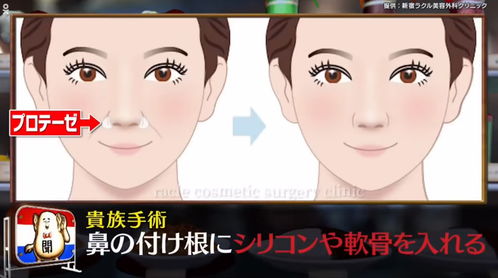 整容有风险，女子花近8万整容整出9级伤残