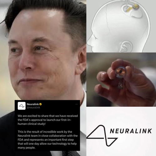 马斯克脑机接口公司 Neuralink 人体试验获得 FDA 批准