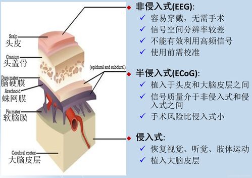 美国脑机接口解冻渐冻症患者控制能力 3个月90%准确率
