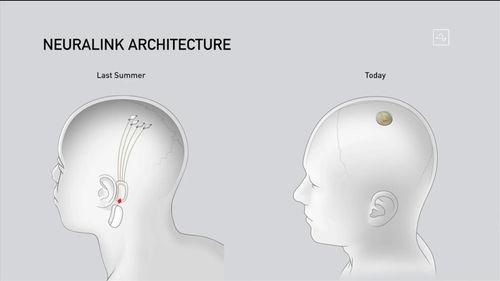 马斯克：Neuralink正开发视觉芯片 几年内有望帮助失明人士恢复光明