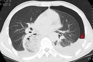 重生细胞开放性伤口怎么获取 开放性伤口图纸在哪